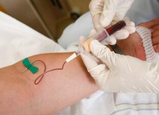 血流变检查什么项目？
